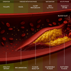 Cardiac Health Panel + Interpretation with HUM2N Expert Physician - HUM2N: Longevity Shop