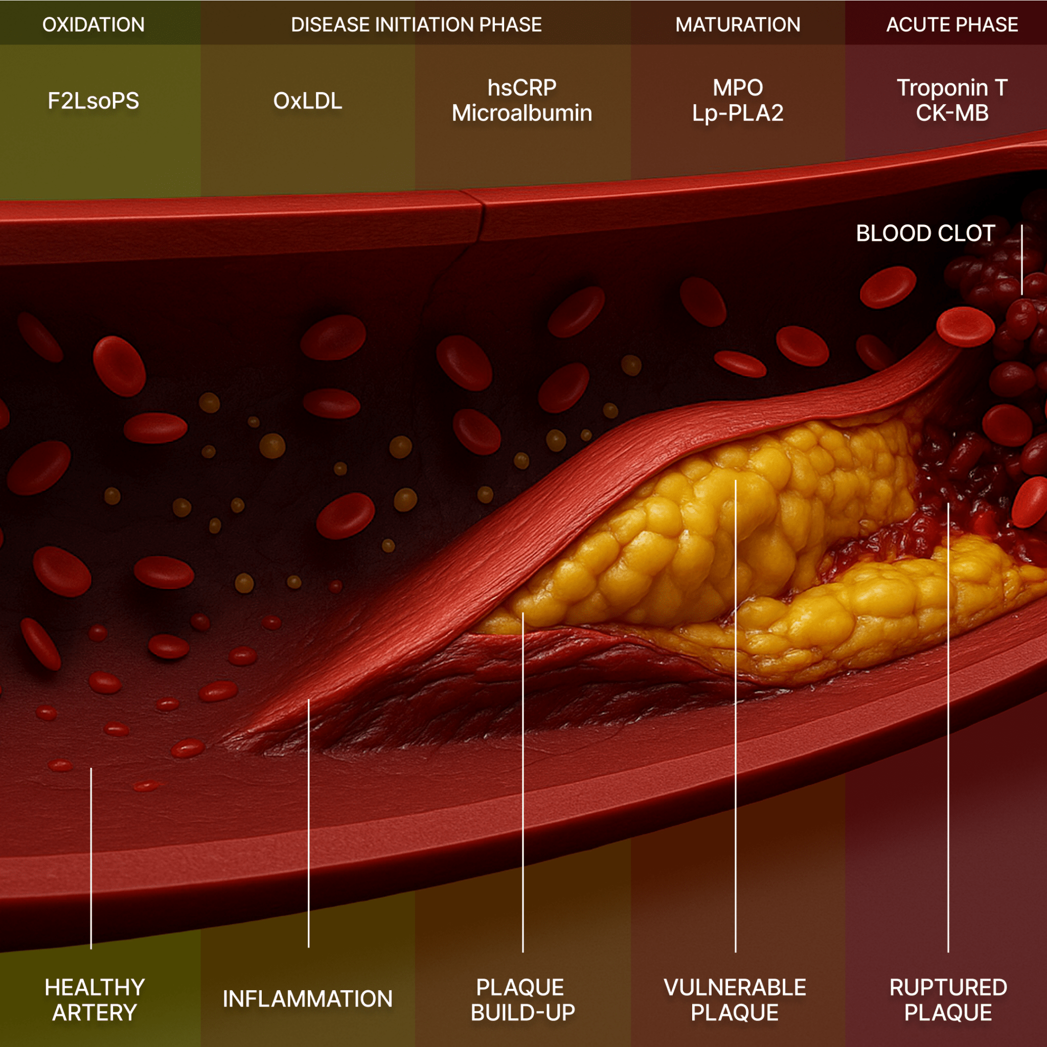 Cardiac Health Panel + Interpretation with HUM2N Expert Physician - HUM2N: Longevity Shop